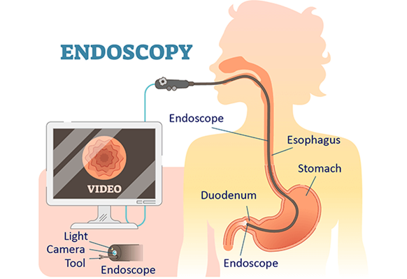 endoscopy in Karachi